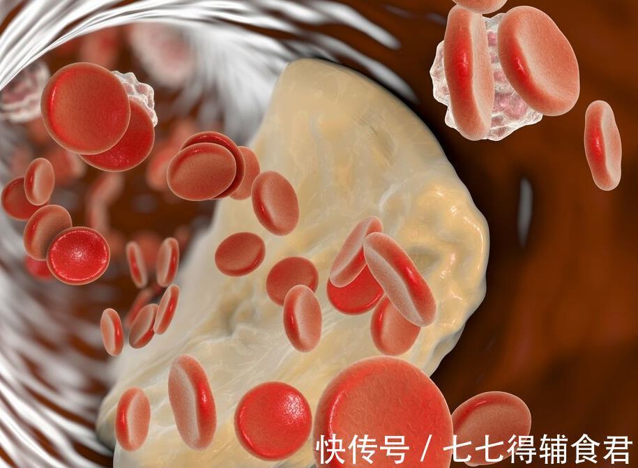 内科|吃一口等于5斤燕麦，内科主任直言：若你常吃，血管通透不堵