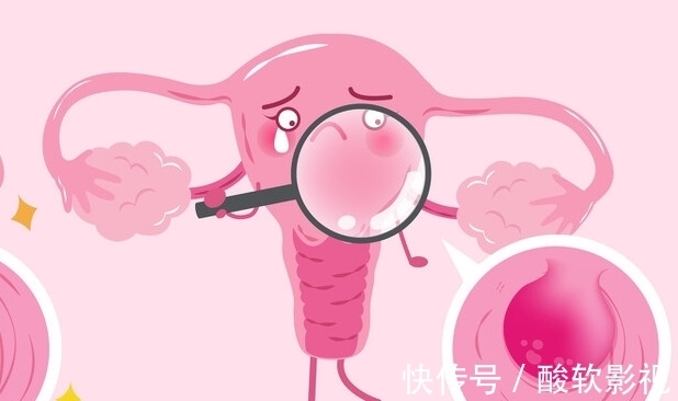 寻常疣|身体3个地方发痒,是HPV来了,趁早去检查,别误以为是过敏