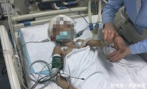 尿毒症|2岁孩子吃了水果有尿毒症,奶奶送去医院,真相让人叹息