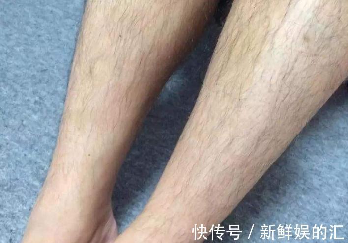 饮食习惯|为什么有的女性体毛旺盛，有的“光秃秃”的？这是什么原因呢？