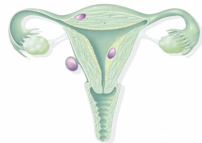 附件炎|宫颈有时会抽一下的疼，是怎么回事？