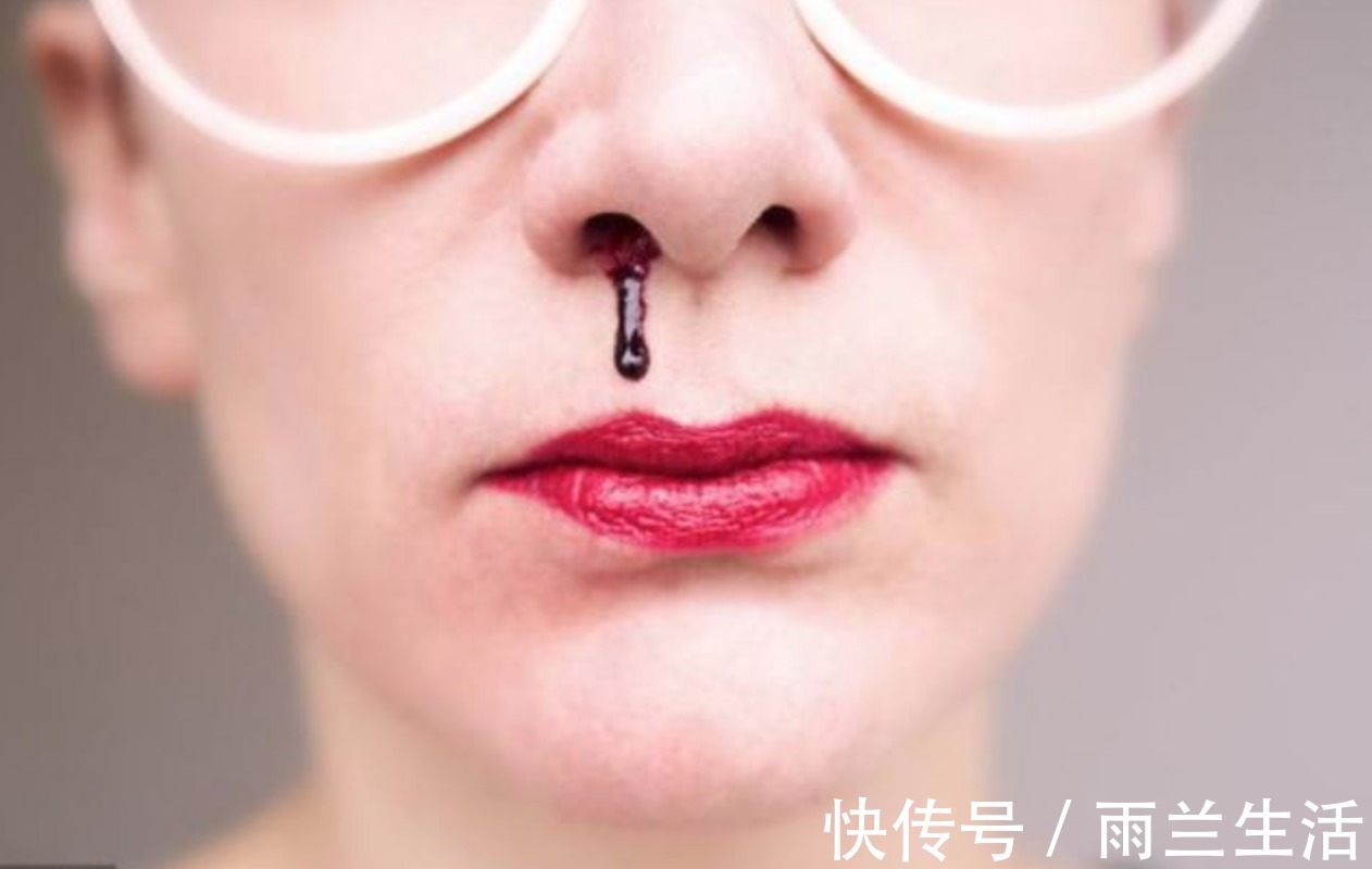 抗氧化剂|高血压患者,脸上出现3种表现,最好及时检查,脑出血要来了