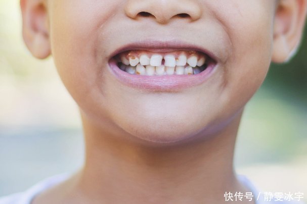 孩子|牙科医生告诉你：孩子蛀牙原因多，第三点一定要看，否则以后会后悔