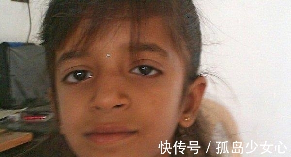 女孩|女孩耳朵疼,医生往女孩耳朵边放糖,结果出来了让人害怕的东西