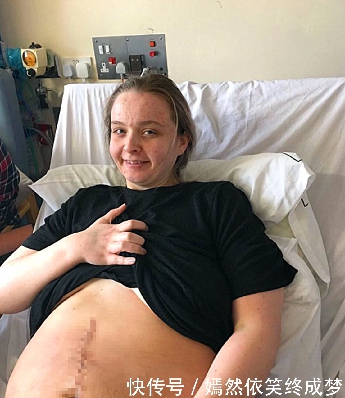 法维尔|英国女子肚子涨大以为怀有身孕,医生发现她腹中并非胎儿