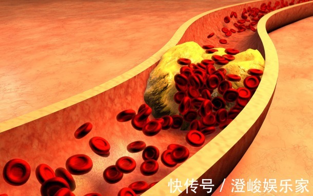 幸福指数|不论男女,50岁后有三道坎,若能熬过去,长寿会与你有缘