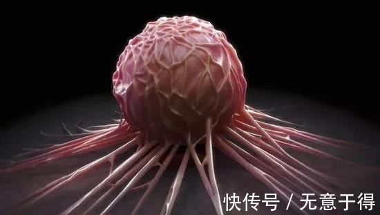 癌症患者|癌症晚期到底要不要治疗?肿瘤专科医生说出了一番心里话