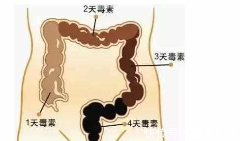 维生素c|长期便秘的人, 这几种食物要多吃, 调肠胃通宿便, 远离困扰