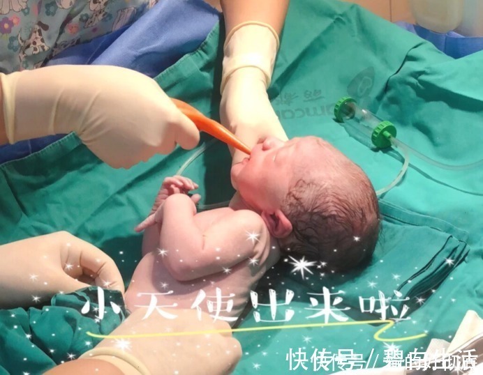 判断|到了孕晚期,怎么判断自己快要生了?看这几点!