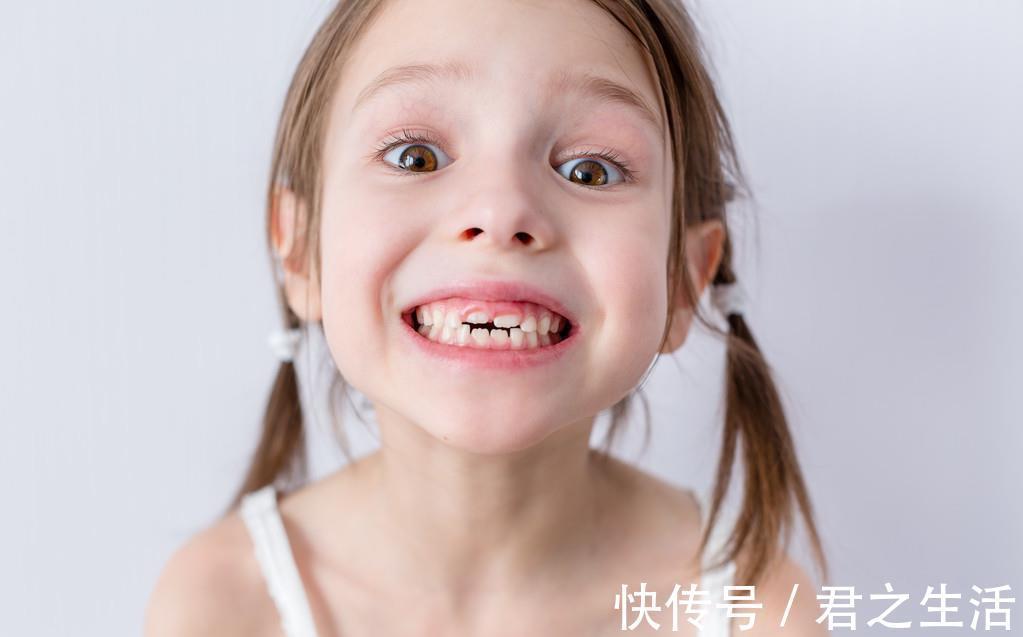 矫治|儿童做牙齿矫正三个最佳时间:家长要牢记,矫治越早干预效果越好