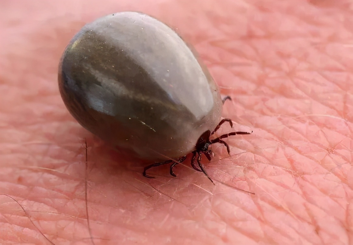 医生|3岁孩子被蜱虫咬,妈妈的“三个果断”救了娃,医生点赞有见识