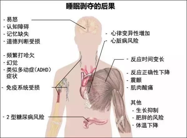 入睡|晚上睡多久，决定你生啥病、活多久！你的年龄该睡多长时间？1张表告诉你