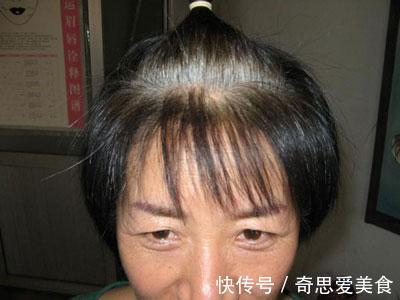 染发剂|经常染发的老年人,要养成这三个养护好习惯,头皮健康不伤发