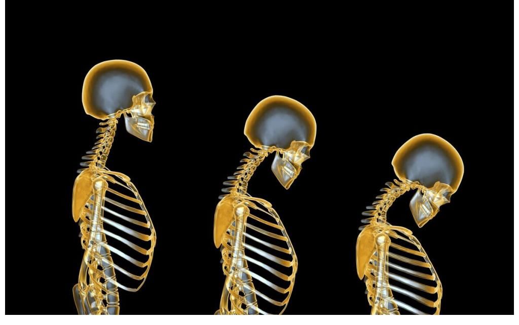 骨组织|骨科专家：预防骨质疏松，这几点请记好