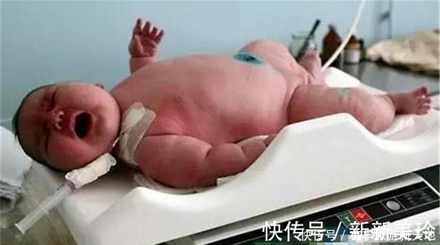 孕期|“最肥孕妇”走红,体重500斤成功顺产,丈夫看见娃后却欲哭无泪