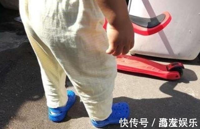 孩子|6岁宝宝双脚“变形”只因常年穿“这种鞋”,父母要重视起来