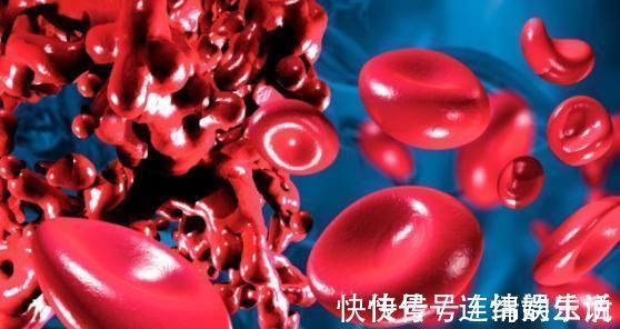 血液脂肪|血稠的“清脂药”找到了,饭前2口,降低血液脂肪,血液恢复活性