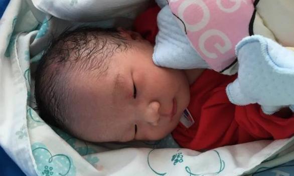 医生|28岁孕妇子宫被胎儿“踢破”，母子险些丧命，只因之前做过这事