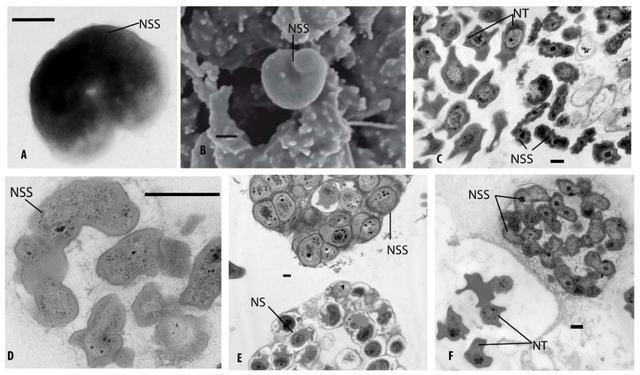 地球有多热，2020年气温再创新高，冻土融化，人类为何不安？