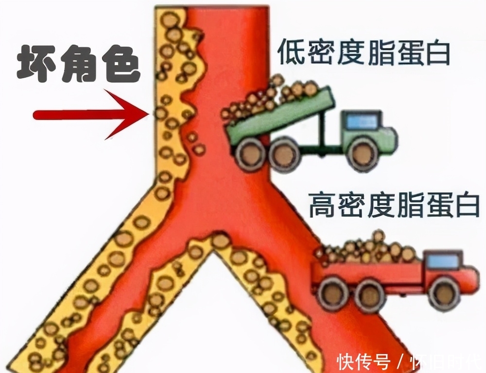 吃鸡蛋与人体胆固醇的关系,一文说清楚