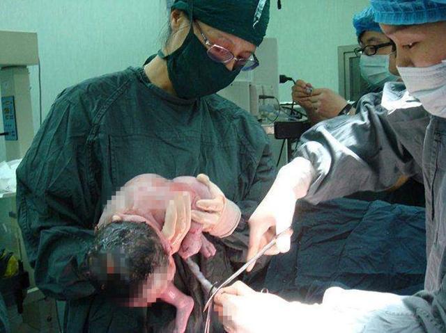 新生儿|宝宝出生后的10几分钟,在“折腾”什么原来他比妈妈更忙