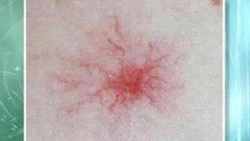 胆汁|养肝的“冠军”已揭晓，不是胡萝卜，平时敞开吃，肝病或绕道走