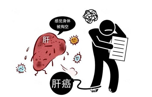 信号|肝癌一发现就是晚期?4个信号别大意,肝部或正遭受癌细胞侵袭