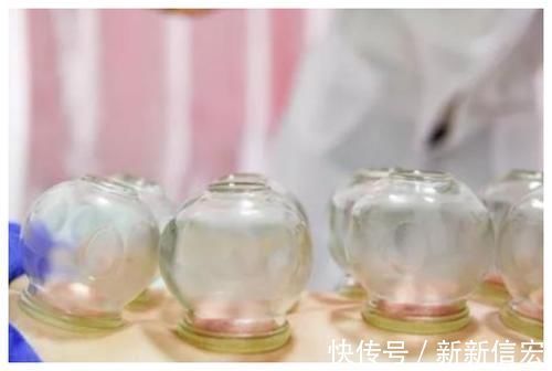 负压|拔罐真的能排毒吗,拔完后的淤血到底是什么?医生终于道出真相