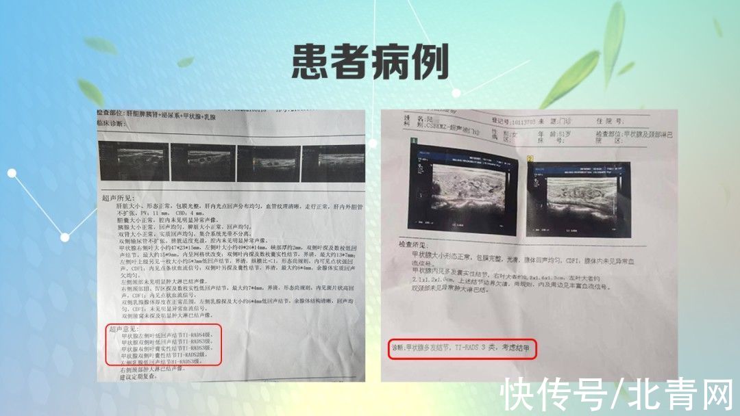 甲状腺癌|查出这类结节、息肉，再小也别忽视！中医平肝健脾，消结节、除息肉，化解肿瘤危机防复发