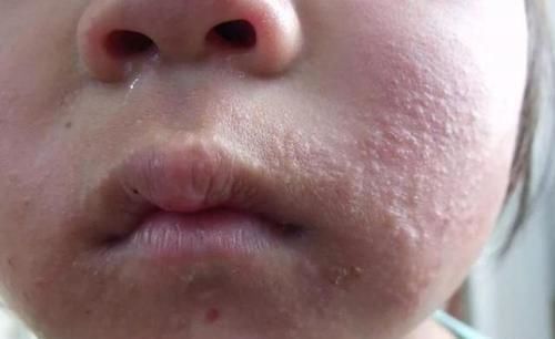 杨桃|宝宝1岁前不能吃的3种水果,宝妈要记牢,对孩子身体没好处