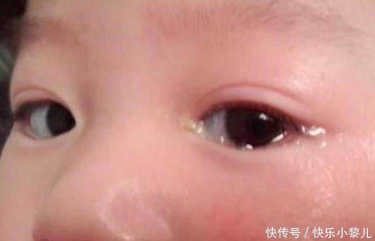 侄女|15岁少女凭借“蚂蚁腰”走红,确实“细得不像话”!