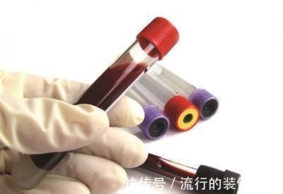 胰岛素抵抗|空腹血糖7.1，少吃多动三个月5.4，为糖尿病吗？查一项指标便知道