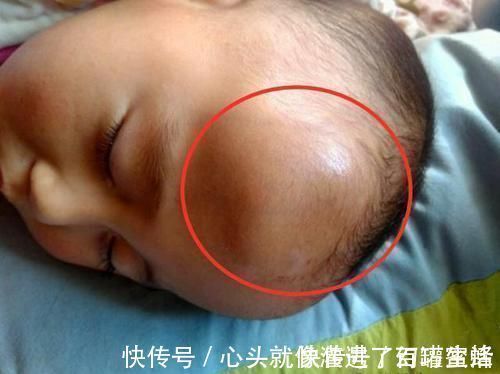 家长|1岁宝宝摔下床,妈妈的做法让奶奶直呼太冷血!医生却说:做得对