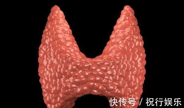 懒癌|甲状腺癌是“懒癌”?患者若是在中晚期发现病情,情况不乐观