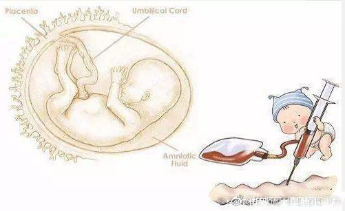 符合|保存脐带血时，孕妇和宝宝必须符合什么特殊条件爱的脐迹