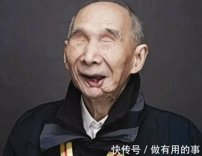 血脂|高血脂不能吃土豆?医生提醒:一旦血脂偏高,这3种素食也要忌口