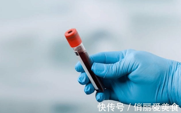 血脂异常|多走路可以降血脂?专家提醒:过了50岁,这3事或比运动更有效