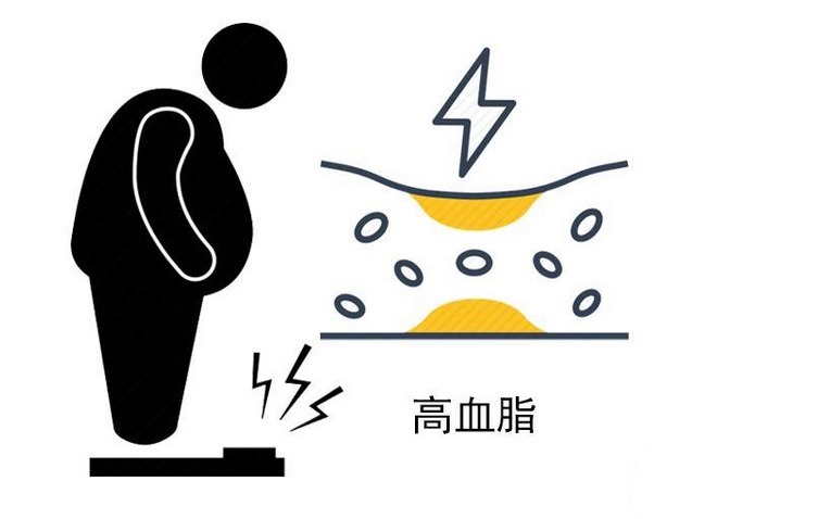 并发症|糖尿病患者,控制血糖务必做好4点,否则,控糖药等于白吃