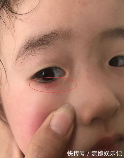 发育|14岁男孩身高已有183cm,儿科医生:4种食物是入秋“长高王”