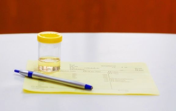 血糖|糖尿病患者的尿又黄又骚是什么原因？你真的知道吗？看专家的理解