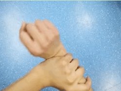 桡骨茎突狭窄性腱鞘炎|“妈妈手”是怎么形成的？它可不是妈妈的专利