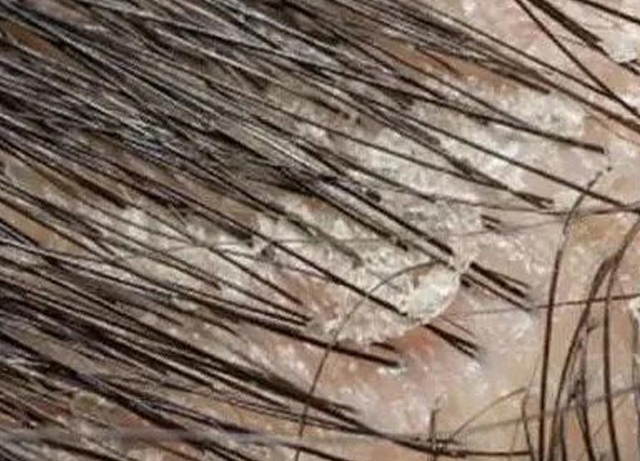 理发店|早上刚刚洗的头发怎么又油了?到底是怎么回事?