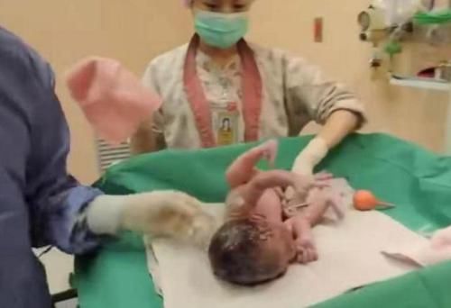 一组图带你了解:宝宝出生后,被医生抱走的神秘十分钟都经历了啥