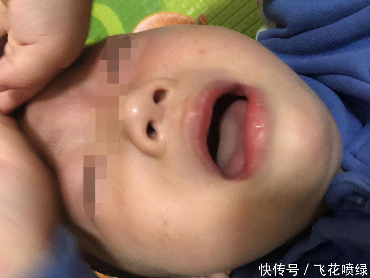 健康状况|从鼻涕看健康状况孩子出现这4种症状,家长应及时带他去医院