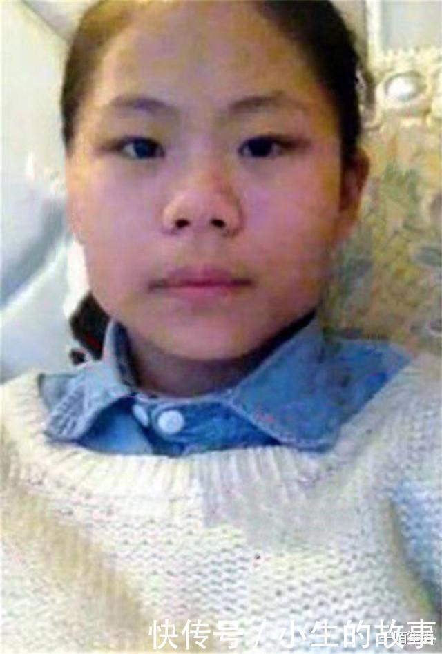 3年花费近百万,整了60次容的“网红”娜娜,现在过得怎么样