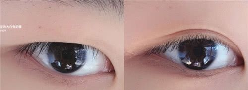 小姐姐|单眼皮小姐姐快来领福利,教你“变”出双眼皮方法