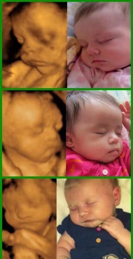 体表|为何有的医院做四维彩超不让家属陪?这3大原因,孕妇有权知道