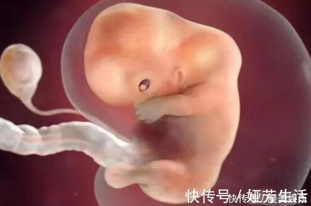 高发期|十月怀胎,哪几周是胎儿畸形的高发期看完后明白了