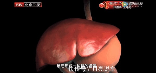 脾胃论|身边的“天然解毒王”!每天吃一点,健脾祛湿、给肝脏洗洗澡