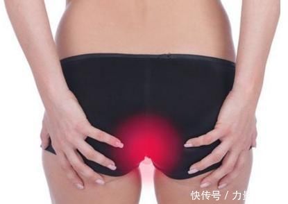 痔疮|痔疮还是肠癌,记住4个“区别”,能让你远离“肠癌”,一起学习